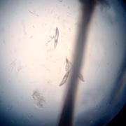 клещи (Demodex canis)